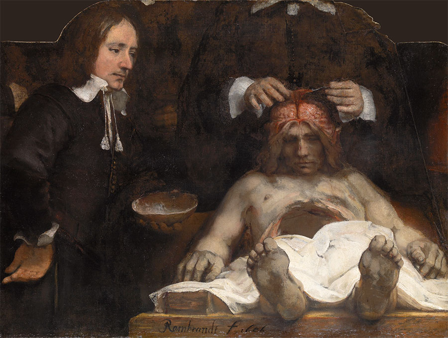 Rembrandt - La lección de anatomía del doctor Deyman 